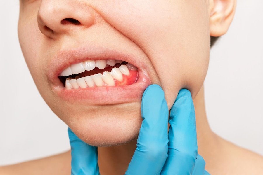 gum-inflammation-young-womans-face-with-doctor-gloved-hand-her-jaw-showing-red-bleeding-gums_407348-1549
